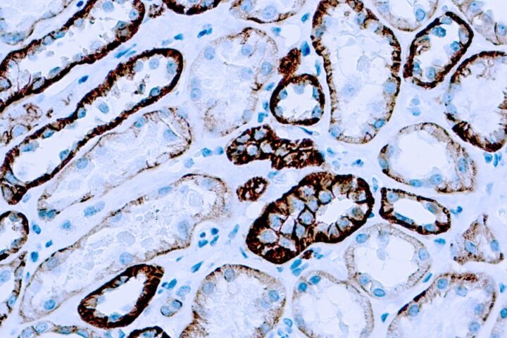 Immunohistochemical staining of Cadherin, Pan  of human FFPE tissue followed by incubation with HRP labeled secondary and development with DAB substrate.