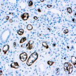 Immunohistochemical staining of C4d  of human FFPE tissue followed by incubation with HRP labeled secondary and development with DAB substrate.