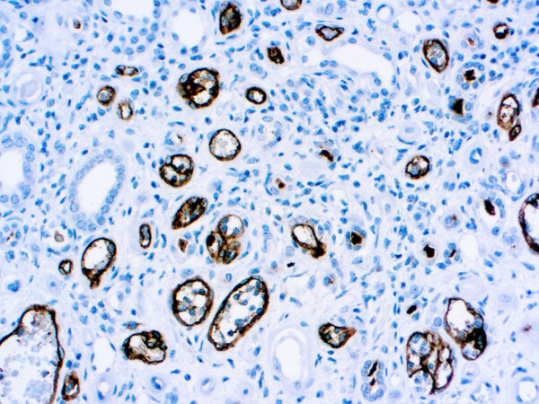 Immunohistochemical staining of C4d  of human FFPE tissue followed by incubation with HRP labeled secondary and development with DAB substrate.
