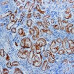 Immunohistochemical staining of Calponin  of human FFPE tissue followed by incubation with HRP labeled secondary and development with DAB substrate.