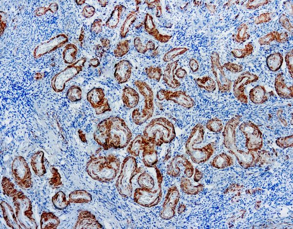 Immunohistochemical staining of Calponin  of human FFPE tissue followed by incubation with HRP labeled secondary and development with DAB substrate.