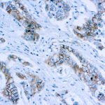 Immunohistochemical staining of Catenin, beta  of human FFPE tissue followed by incubation with HRP labeled secondary and development with DAB substrate.