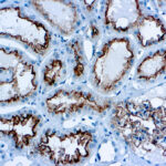 Immunohistochemical staining of CD10  of human FFPE tissue followed by incubation with HRP labeled secondary and development with DAB substrate.