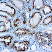 Immunohistochemical staining of CD10  of human FFPE tissue followed by incubation with HRP labeled secondary and development with DAB substrate.