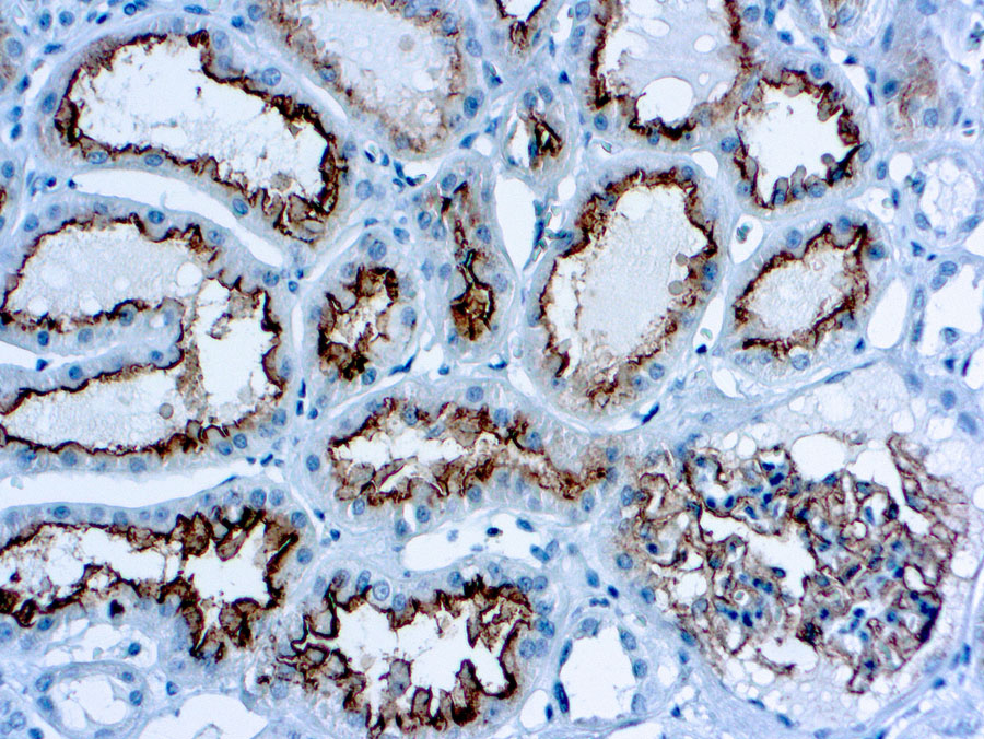 Immunohistochemical staining of CD10  of human FFPE tissue followed by incubation with HRP labeled secondary and development with DAB substrate.