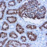 Immunohistochemical staining of CD10/CALLA  of human FFPE tissue followed by incubation with HRP labeled secondary and development with DAB substrate.