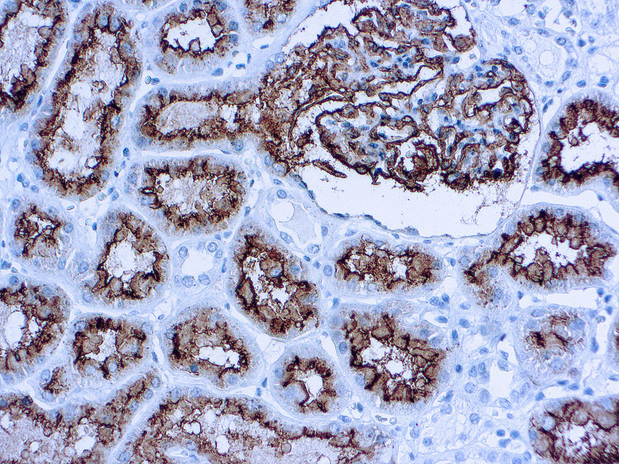 Immunohistochemical staining of CD10/CALLA  of human FFPE tissue followed by incubation with HRP labeled secondary and development with DAB substrate.