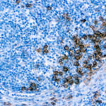 Immunohistochemical staining of CD138  of human FFPE tissue followed by incubation with HRP labeled secondary and development with DAB substrate.