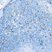 Immunohistochemical staining of CD163  of human FFPE tissue followed by incubation with HRP labeled secondary and development with DAB substrate.