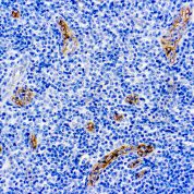 Immunohistochemical staining of CD105  of human FFPE tissue followed by incubation with HRP labeled secondary and development with DAB substrate.