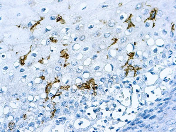 Immunohistochemical staining of CD1a  of human FFPE tissue followed by incubation with HRP labeled secondary and development with DAB substrate.
