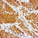 Immunohistochemical staining of Actin, Smooth Muscle  of human FFPE tissue followed by incubation with HRP labeled secondary and development with DAB substrate.