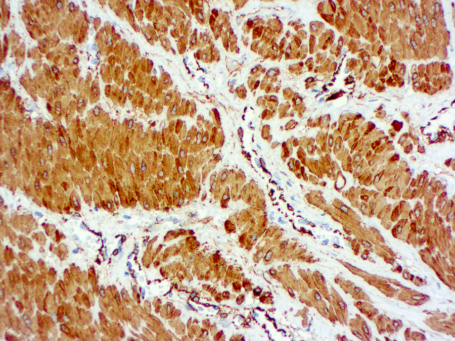 Immunohistochemical staining of Actin, Smooth Muscle  of human FFPE tissue followed by incubation with HRP labeled secondary and development with DAB substrate.
