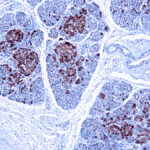 Immunohistochemical staining of Chromogranin A  of human FFPE tissue followed by incubation with HRP labeled secondary and development with DAB substrate.