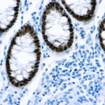 Immunohistochemical staining of Cdx2  of human FFPE tissue followed by incubation with HRP labeled secondary and development with DAB substrate.