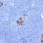 Immunohistochemical staining of Chromogranin A  of human FFPE tissue followed by incubation with HRP labeled secondary and development with DAB substrate.