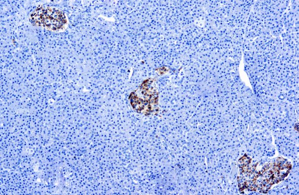 Immunohistochemical staining of Chromogranin A  of human FFPE tissue followed by incubation with HRP labeled secondary and development with DAB substrate.